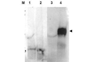 Image no. 1 for anti-Fibroblast Activation Protein, alpha (FAP) (Internal Region) antibody (ABIN401429)