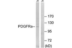 Western blot analysis of extracts from Jurkat cells, using PDGFRa (Ab-849) Antibody.