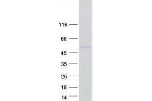 Validation with Western Blot