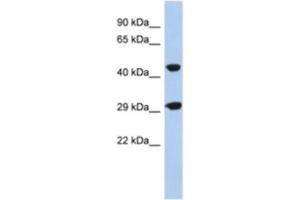 Western Blotting (WB) image for anti-Chromosome 22 Open Reading Frame 25 (C22orf25) antibody (ABIN2463925) (C22orf25 antibody)