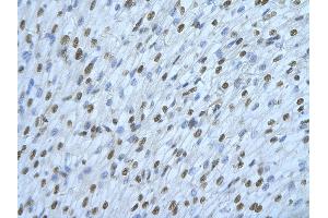 Immunohistochemistry (IHC) image for anti-Heterogeneous Nuclear Ribonucleoprotein D-Like (HNRPDL) (Middle Region) antibody (ABIN2778937)