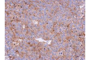 IHC-P Image Immunohistochemical analysis of paraffin-embedded PC13 xenograft, using Calpain 1, antibody at 1:500 dilution. (CAPN1 antibody)