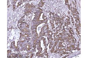 IHC analysis of ABP1/AOC1 using anti-ABP1/AOC1 antibody (ABIN7600040). (DAO antibody  (AA 140-180))
