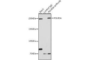 Immunoprecipitation analysis of 200 μg extracts of HeLa cells using 3 μg POLR2A antibody (ABIN3022932, ABIN3022933, ABIN3022934 and ABIN6219303). (POLR2A/RPB1 antibody  (AA 1-260))
