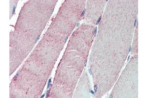 IHC testing of FFPE human skeletal muscle tissue with OSBPL1A antibody at 5ug/ml. (OSBPL1A antibody)