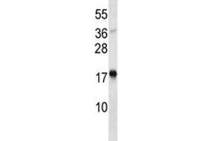 TSLP antibody western blot analysis in Jurkat lysate. (Thymic Stromal Lymphopoietin antibody  (AA 101-130))