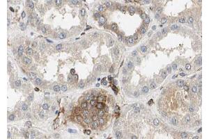 ABIN6272896 at 1/100 staining Mouse kidney tissue by IHC-P. (TIMM23 antibody  (N-Term))