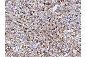 IHC analysis of EGFR using anti-EGFR antibody (ABIN7601478). (EGFR antibody  (AA 36-497))