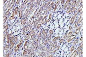 IHC analysis of TRPV5 using anti-TRPV5 antibody (ABIN7600034).