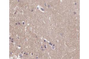 ABIN6266548 at 1/200 staining human brain tissue sections by IHC-P. (Metabotropic Glutamate Receptor 4 antibody  (C-Term))