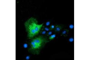 Anti-CLPP mouse monoclonal antibody (ABIN2453957) immunofluorescent staining of COS7 cells transiently transfected by pCMV6-ENTRY CLPP (RC200301). (CLPP antibody)