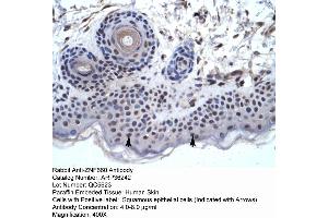 Human Skin (ZNF660 antibody  (C-Term))