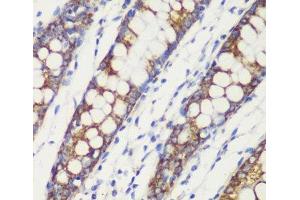 Immunohistochemistry of paraffin-embedded Human colon using TOM20 Polyclonal Antibody at dilution of 1:100 (40x lens).