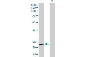 Western Blot analysis of BAG2 expression in transfected 293T cell line by BAG2 MaxPab polyclonal antibody. (BAG2 antibody  (AA 1-211))