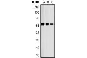Western blot analysis of PSMD12 expression in A431 (A), COLO320 (B), HeLa (C) whole cell lysates.