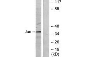 Western blot analysis of extracts from HeLa cells, using c-Jun (Ab-91) Antibody. (C-JUN antibody  (AA 58-107))