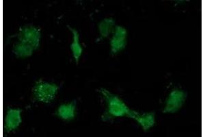 Anti-ATP6V1B1 mouse monoclonal antibody (ABIN2454421) immunofluorescent staining of COS7 cells transiently transfected by pCMV6-ENTRY ATP6V1B1 (RC209462). (ATP6V1B1 antibody)