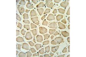 Immunohistochemistry analysis in formalin fixed and paraffin embedded skeletal muscle reacted with PGP Antibody (N-term) followed which was peroxidase conjugated to the secondary antibody and followed by DAB staining. (PGP antibody  (N-Term))