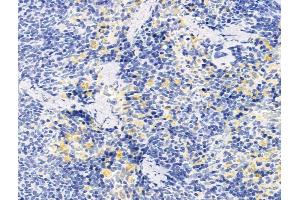 ABIN7094732 and ABIN7098783 at 1/100 staining Rat spleen tissue by IHC-P.