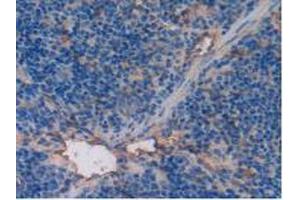 Detection of TM in Mouse Spleen Tissue using Polyclonal Antibody to Thrombomodulin (TM) (Thrombomodulin antibody  (AA 31-167))