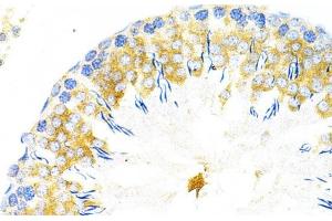 Immunohistochemistry of paraffin-embedded Rat testis using TAPBP Polyclonal Antibody at dilution of 1:200 (40x lens).