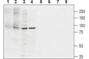 Western blot analysis of rat heart membranes (lanes 1 and 5), mouse heart membranes (lanes 2 and 6), rat PC12 pheochromocytoma cell line lysate (lanes 3 and 7) and human Jurkat T cell leukemia cell line lysate (lanes 4 and 8): - 1-4. (ATP2A2 antibody  (AA 498-510))