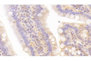 Immunohistochemistry (IHC) image for anti-Leptin Receptor (LEPR) (AA 238-375) antibody (ABIN7430879)