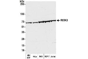 Western Blotting (WB) image for anti-RRIO Kinase 3 (RIOK3) (AA 469-519) antibody (ABIN7452627)