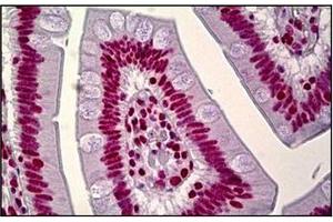 Immunohistochemistry (Paraffin-embedded Sections) (IHC (p)) image for anti-Heterogeneous Nuclear Ribonucleoprotein A1 (HNRNPA1) antibody (ABIN1107590)