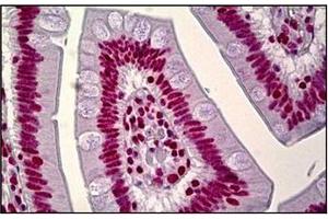 Human Small Intestine: Formalin-Fixed, Paraffin-Embedded (FFPE) (HNRNPA1 antibody)