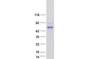 Validation with Western Blot (RFFL Protein (Transcript Variant 1) (Myc-DYKDDDDK Tag))