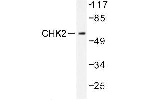 Image no. 1 for anti-Checkpoint Kinase 2 (CHEK2) (pSer379) antibody (ABIN272011) (CHEK2 antibody  (pSer379))