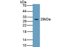 Detection of Recombinant ITGb6, Human using Monoclonal Antibody to Integrin Beta 6 (ITGb6) (ITGB6 antibody  (AA 131-371))