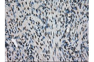 Immunohistochemical staining of paraffin-embedded colon tissue using anti-MKI67mouse monoclonal antibody. (Ki-67 antibody  (AA 1-250))