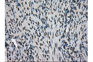 Immunohistochemical staining of paraffin-embedded colon tissue using anti-MKI67mouse monoclonal antibody.