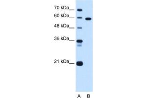 Western Blotting (WB) image for anti-T-Box 15 (TBX15) antibody (ABIN2463095)