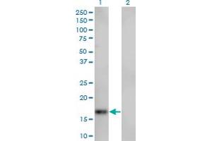 Western Blot analysis of SPIRE1 expression in transfected 293T cell line by SPIRE1 monoclonal antibody (M01), clone 4C5. (SPIRE1 antibody  (AA 482-583))