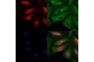 ABIN6260152 and ABIN6279149 staining  cells by IF/ICC.