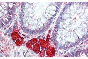 Immunohistochemistry (IHC) image for anti-Hexosaminidase B (Beta Polypeptide) (HEXB) (AA 122-311) antibody (ABIN7438553)