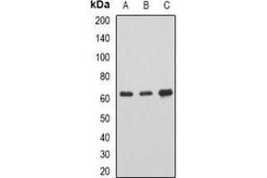 Western blot analysis of AHCYL1 expression in SKOV3 (A), mouse brain (B), rat spinal cord (C) whole cell lysates. (AHCYL1 antibody)