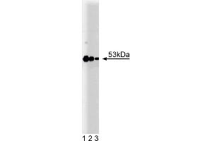 Western Blotting (WB) image for anti-Protein Kinase, CAMP-Dependent, Regulatory, Type II, beta (PRKAR2B) (AA 1-418) antibody (ABIN968073) (PRKAR2B antibody  (AA 1-418))