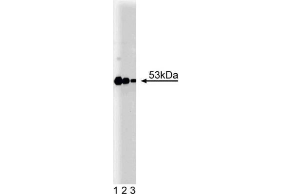 PRKAR2B Antikörper  (AA 1-418)