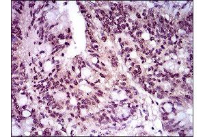Immunohistochemistry (IHC) image for anti-T Antigen (AA 257-309) antibody (ABIN1845736) (T Antigen (AA 257-309) antibody)