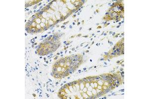 Immunohistochemistry of paraffin-embedded human colon using TNFSF11 Antibody (ABIN5971376) at dilution of 1/100 (40x lens).