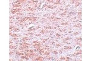 Immunohistochemistry (Paraffin-embedded Sections) (IHC (p)) image for anti-Caudal Type Homeobox 2 (CDX2) (C-Term) antibody (ABIN499613)