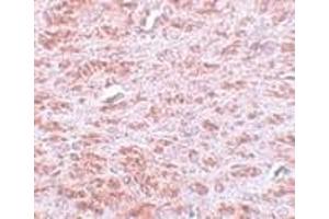 Immunohistochemistry of CDX2 in rat brain tissue with CDX2 antibody at 5 μg/ml. (CDX2 antibody  (C-Term))