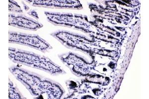 Immunohistochemistry (IHC) image for anti-Heterogeneous Nuclear Ribonucleoprotein A1 (HNRNPA1) (AA 8-42) antibody (ABIN5647145)
