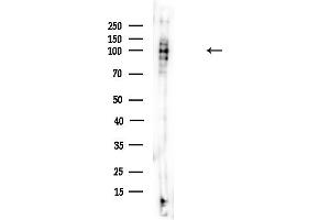 anti-Epidermal Growth Factor Receptor Pathway Substrate 15-Like 1 (EPS15L1) (C-Term) antibody