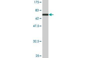 Western Blot detection against Immunogen (70. (SIGIRR antibody  (AA 1-410))