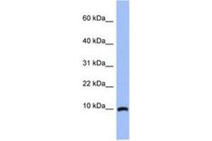 Image no. 1 for anti-Acyl-CoA Binding Domain Containing 7 (ACBD7) (N-Term) antibody (ABIN6744031) (ACBD7 antibody  (N-Term))